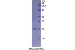 SDS-PAGE analysis of Rat NOS1 Protein. (NOS1 Protein)