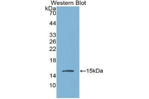 Western blot analysis of the recombinant protein. (AGGF1 Antikörper  (AA 406-501))