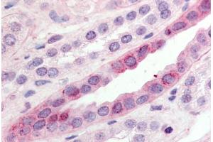 Human Kidney (formalin-fixed, paraffin-embedded) stained with GPR15 antibody ABIN213351 at 10 ug/ml followed by biotinylated goat anti-rabbit IgG secondary antibody ABIN481713, alkaline phosphatase-streptavidin and chromogen. (GPR15 Antikörper  (C-Term))