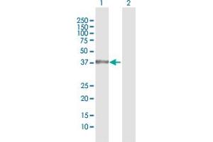Western Blotting (WB) image for anti-Nuclear Receptor Subfamily 1, Group I, Member 3 (NR1I3) (AA 1-352) antibody (ABIN523345)