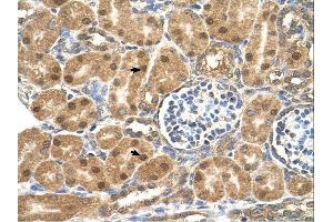 P4HB antibody was used for immunohistochemistry at a concentration of 4-8 ug/ml. (P4HB Antikörper  (N-Term))