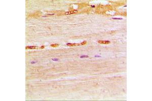 Immunohistochemical analysis of UDG staining in human muscle formalin fixed paraffin embedded tissue section.