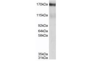 Image no. 2 for anti-ATP-Binding Cassette, Sub-Family C (CFTR/MRP), Member 4 (ABCC4) (C-Term) antibody (ABIN374484)