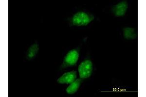 Immunofluorescence of purified MaxPab antibody to TRMT2A on HeLa cell. (TRMT2A Antikörper  (AA 1-625))