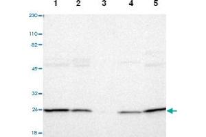 Western blot analysis of Lane 1: Human cell line RT-4, Lane 2: Human cell line U-251MG sp, Lane 3: Human plasma (IgG/HSA depleted), Lane 4: Human liver tissue, Lane 5: Human tonsil tissue with PSMD10 polyclonal antibody  at 1:250-1:500 dilution. (PSMD10 Antikörper)