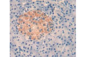 Used in DAB staining on fromalin fixed paraffin- embedded pancreas tissue (XRN1 Antikörper  (AA 1394-1706))