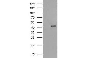 HEK293T cells were transfected with the pCMV6-ENTRY control (Left lane) or pCMV6-ENTRY ADH1B (Right lane) cDNA for 48 hrs and lysed. (ADH1B Antikörper)