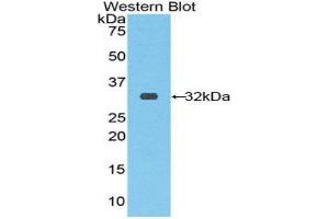 Western Blotting (WB) image for anti-Ribonuclease/angiogenin Inhibitor 1 (RNH1) (AA 76-333) antibody (ABIN1860443)