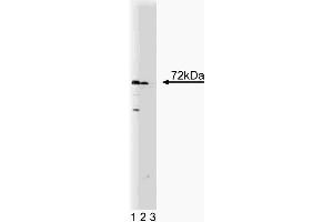 Western blot analysis of SNX2 on a human endothelial cell lysate. (Sorting Nexin 2 Antikörper  (AA 15-137))