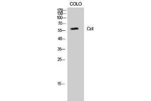 Western Blotting (WB) image for anti-Carnitine O-Octanoyltransferase (CROT) (Ser253) antibody (ABIN6283400)