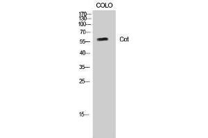Western Blotting (WB) image for anti-Carnitine O-Octanoyltransferase (CROT) (Ser253) antibody (ABIN3174521) (CROT Antikörper  (Ser253))