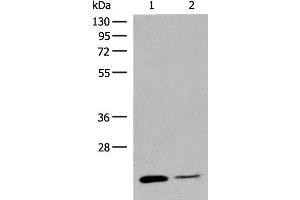 Western blot analysis of Human empty ileal tissue and Human ileum tissue lysates using RAC3 Polyclonal Antibody at dilution of 1:400 (RAC3 Antikörper)