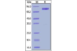 Human IL-23 R, Fc Tag on  under reducing (R) condition. (IL23R Protein (AA 24-355) (Fc Tag))