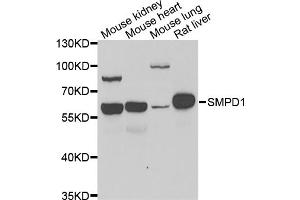 Western blot analysis of extracts of various cell lines, using SMPD1 antibody (ABIN5974079) at 1/1000 dilution. (SMPD1 Antikörper)