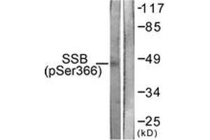 Western blot analysis of extracts from 293 cells, using SSB (Phospho-Ser366) Antibody. (SSB Antikörper  (pSer366))