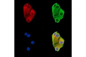 ABIN7096491 and ABIN7100555 staining Hela cells by IF/ICC. (DENND2D Antikörper)