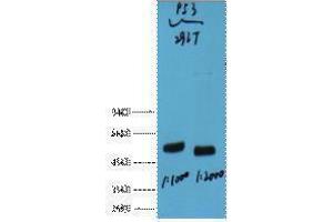 Western Blotting (WB) image for anti-Tumor Protein P53 (TP53) antibody (ABIN3181122) (p53 Antikörper)