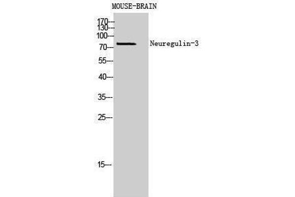 Neuregulin 3 Antikörper  (Internal Region)