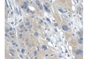 Detection of GAL2 in Human Esophagus Tissue using Monoclonal Antibody to Galectin 2 (GAL2) (Galectin 2 Antikörper  (AA 1-132))