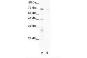 Image no. 1 for anti-Zinc Finger Protein 37A (ZNF37A) (AA 381-430) antibody (ABIN203208) (ZNF37A Antikörper  (AA 381-430))