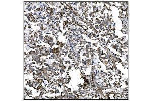 IHC analysis of CD39/ENTPD1 using anti-CD39/ENTPD1 antibody (ABIN7602461). (CD39 Antikörper  (AA 79-411))