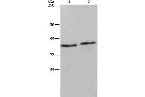 Western Blot analysis of 293T and K562 cell using ITGB2 Polyclonal Antibody at dilution of 1:600 (Integrin beta 2 Antikörper)