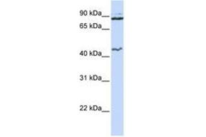 Image no. 1 for anti-Minichromosome Maintenance Deficient 9 (MCM9) (N-Term) antibody (ABIN6742708) (MCM9 Antikörper  (N-Term))