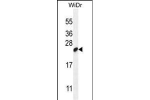 LOC147646 Antibody (C-term) (ABIN655852 and ABIN2850489) western blot analysis in WiDr cell line lysates (35 μg/lane). (C19orf84 Antikörper  (C-Term))