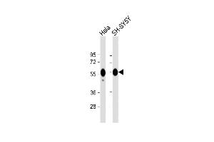 All lanes : Anti-CALR Antibody at 1:1000 dilution Lane 1: Hela whole cell lysate Lane 2: SH-SY5Y whole cell lysate Lysates/proteins at 20 μg per lane. (Calreticulin Antikörper)