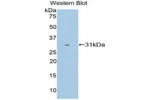 Western blot analysis of the recombinant protein. (CYP1A1 Antikörper  (AA 1-250))