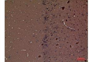 Immunohistochemistry (IHC) image for anti-Hexosaminidase A (HEXA) (Internal Region) antibody (ABIN3187766)