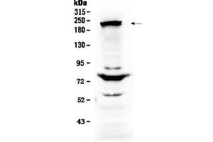 Western blot analysis of CHD2 using anti-CHD2 antibody . (CHD2 Antikörper  (AA 1124-1351))