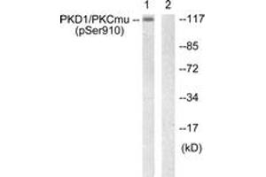 Western blot analysis of extracts from A431 cells, using PKD1/PKC mu (Phospho-Ser910) Antibody. (PKC mu Antikörper  (pSer910))