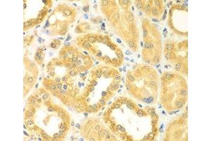 Immunohistochemistry of paraffin-embedded Human kidney using PDE4DIP Polyclonal Antibody at dilution of 1:100 (40x lens). (PDE4DIP Antikörper)