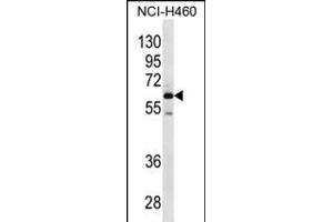 MEPE Antikörper  (N-Term)