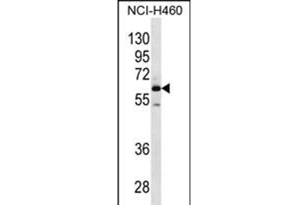 MEPE antibody  (N-Term)