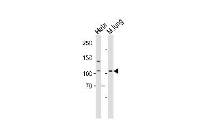 Western blot analysis of lysates from Hela cell line and mouse lung tissue lysate(from left to right), using Mouse Epha4 Antibody (Center) (ABIN6243788 and ABIN6577535). (EPH Receptor A4 Antikörper  (AA 309-342))