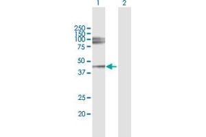 Western Blot analysis of LUM expression in transfected 293T cell line by LUM MaxPab polyclonal antibody. (LUM Antikörper  (AA 1-338))