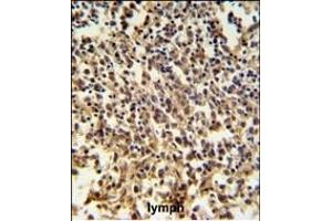 RNASEH2B Antibody (Center) (ABIN650970 and ABIN2840016) IHC analysis in formalin fixed and paraffin embedded human lymph tissue followed by peroxidase conjugation of the secondary antibody and DAB staining. (RNASEH2B Antikörper  (AA 130-157))