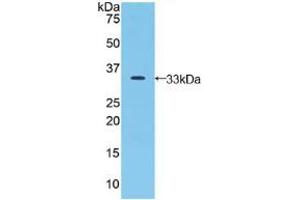 Western blot analysis of recombinant Human JAG2. (JAG2 Antikörper  (AA 714-981))