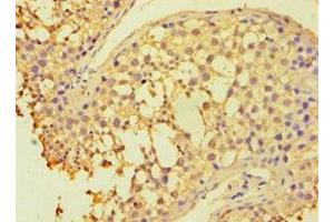 Immunohistochemistry of paraffin-embedded human testis tissue using ABIN7154834 at dilution of 1:100 (HAUS3 Antikörper  (AA 384-603))