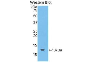 Western blot analysis of the recombinant protein. (SLIT3 Antikörper  (AA 62-119))