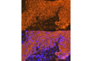 Immunofluorescence analysis of human skin using Cytokeratin 16 (KRT16) Rabbit mAb (ABIN7268094) at dilution of 1:100 (40x lens). (KRT16 Antikörper)
