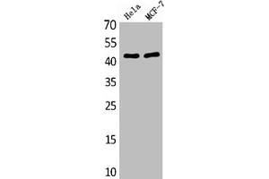 Western Blot analysis of various cells using Antibody diluted at 1:1000. (MEK1 Antikörper  (AA 330-410))