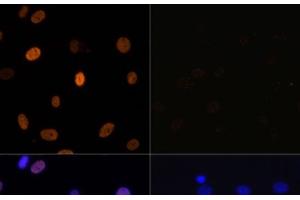 Immunofluorescence (IF) image for anti-Histone H3 (H3) (acLys14), (acLys18), (acLys23), (acLys27), (acLys9) antibody (ABIN7259751)