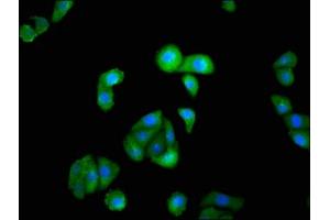 Immunofluorescence staining of HepG2 cells with ABIN7156637 at 1:100, counter-stained with DAPI. (IRF9 Antikörper  (AA 44-180))