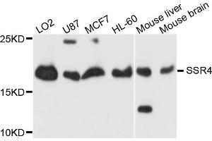 Western blot analysis of extracts of various cell lines, using SSR4 antibody (ABIN5995477) at 1/1000 dilution.