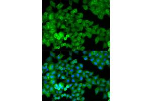 Immunofluorescence analysis of HeLa cells using JUP antibody. (JUP Antikörper)