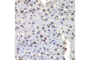 Immunohistochemistry of paraffin-embedded mouse liver using LHX4 antibody at dilution of 1:100 (x400 lens). (LHX4 Antikörper)