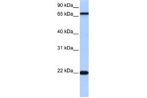 WB Suggested Anti-ACCSL Antibody Titration:  0. (ACCSL Antikörper  (N-Term))